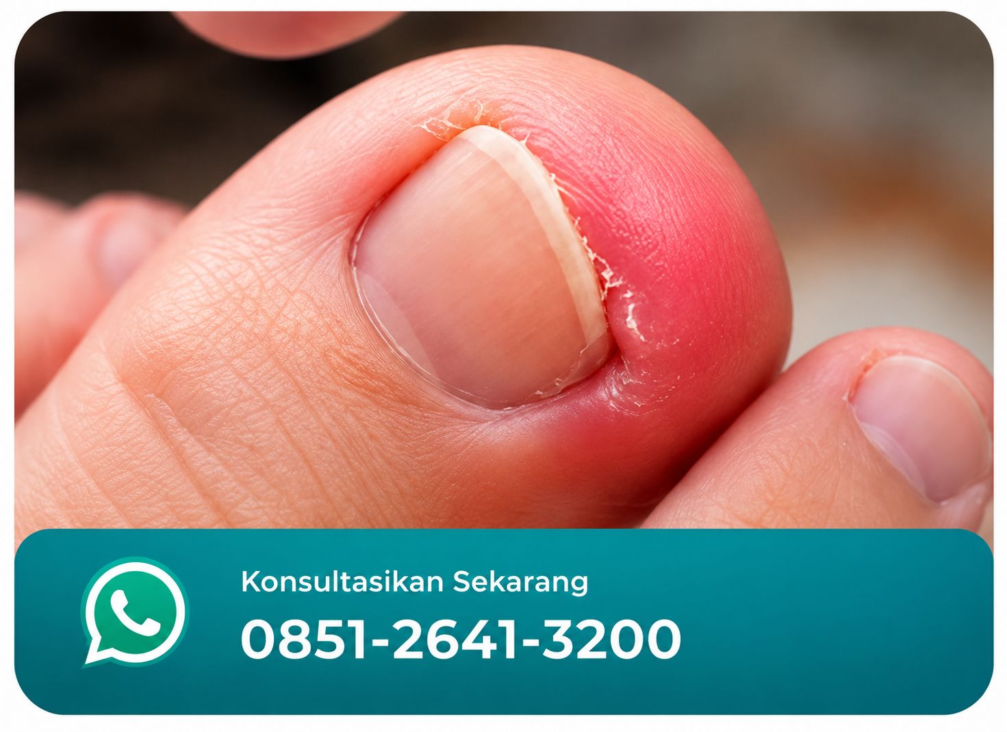 CANTENGAN JANGAN DIBIARKAN