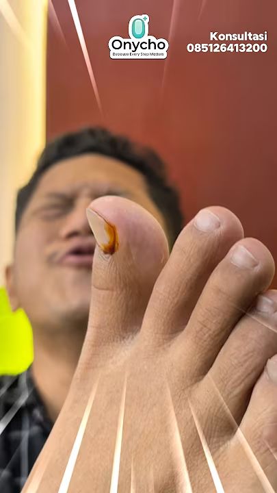 Apa Itu Cantengan